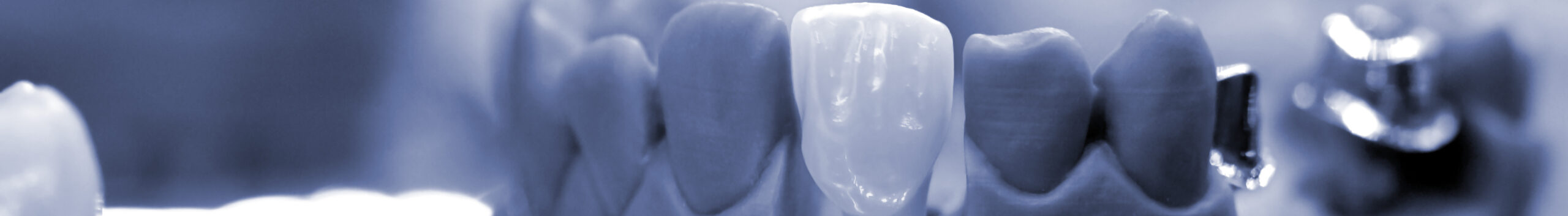 Способы наращивания костной ткани зуба